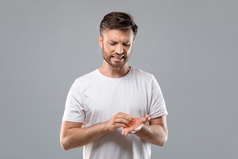 l'homme se gratte la paume
