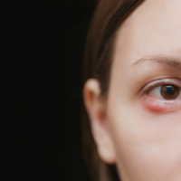 une femme avec un problème oculaire
