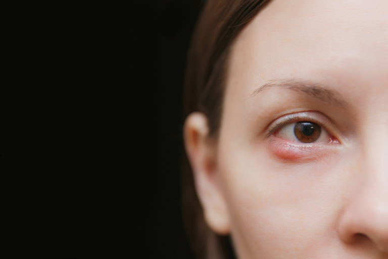 une femme avec un problème oculaire