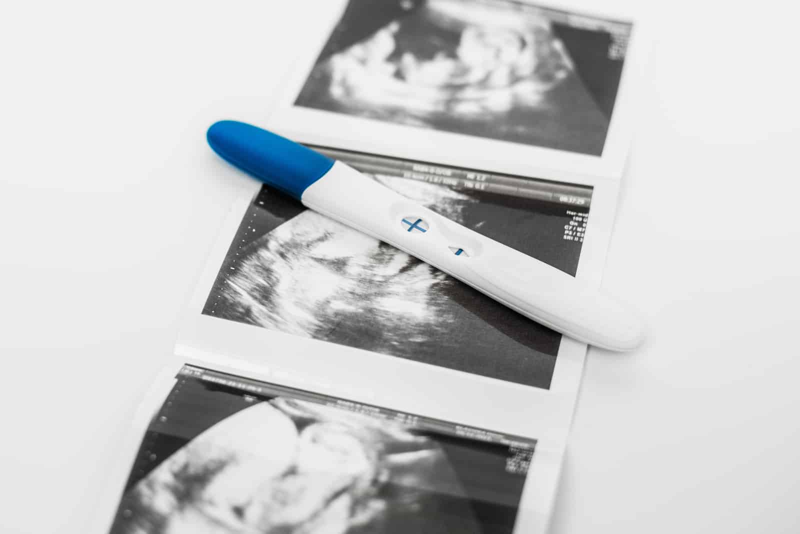 images échographiques et test de grossesse